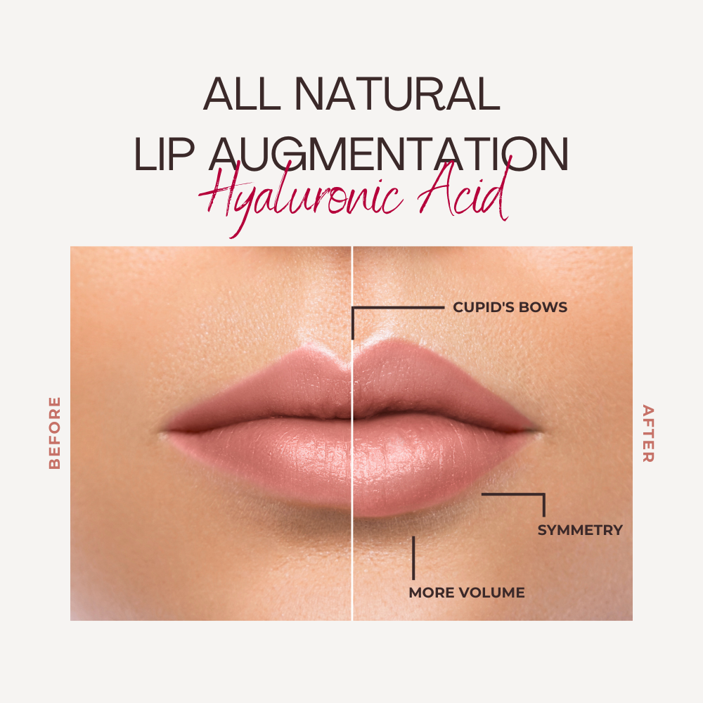 Seoul Naturals Lip Plumper, 100% Natural Ingredients, k beauty, 0.2fl oz